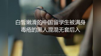 白皙嫩滑的中国留学生被满身毒疮的黑人混混无套后入